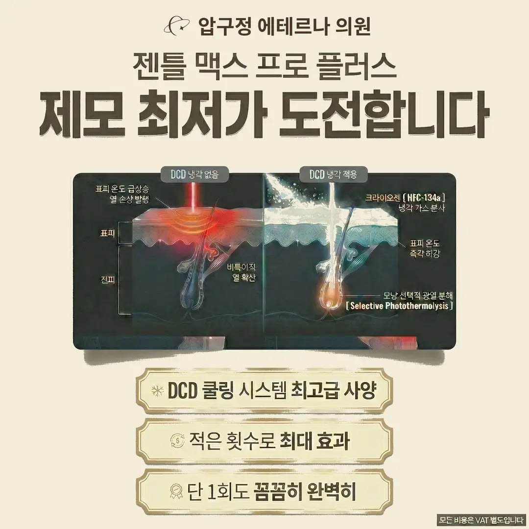 ジェントルマックスプロ脱毛イベント